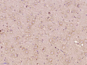DUSP26 Rabbit Polyclonal Antibody
