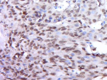 DUX4L9 Rabbit Polyclonal Antibody
