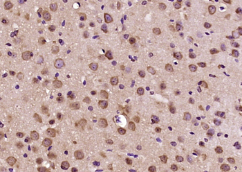 Dynein light chain 2, cytoplasmic Rabbit Polyclonal Antibody