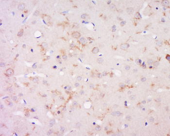 DILP3 Rabbit Polyclonal Antibody