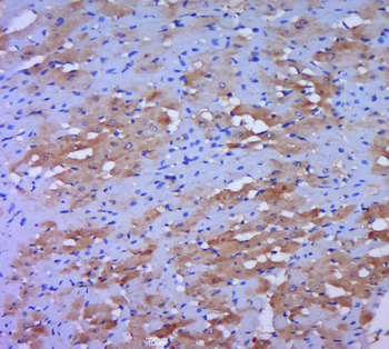 DLD Rabbit Polyclonal Antibody