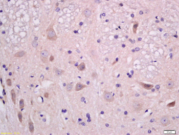 EphA2 Rabbit Polyclonal Antibody