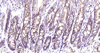 EDARADD Rabbit Polyclonal Antibody
