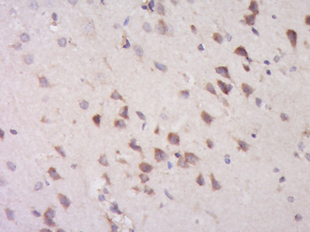 EHBP1 Rabbit Polyclonal Antibody