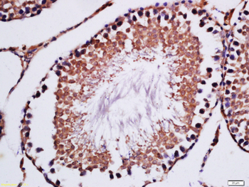 EIF5AL1 Rabbit Polyclonal Antibody