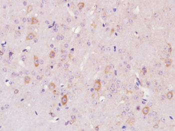 ELMO3 Rabbit Polyclonal Antibody