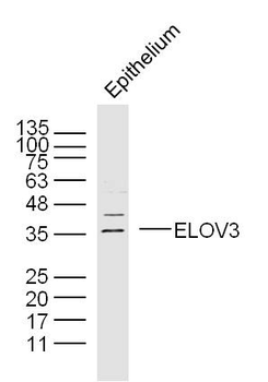 ELOV3 Rabbit Polyclonal Antibody