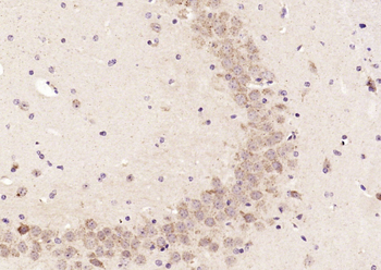 ELP4 Rabbit Polyclonal Antibody