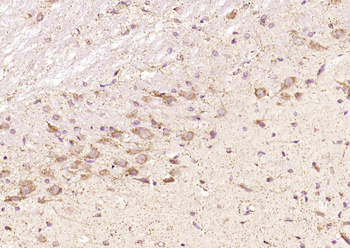 ELP4 Rabbit Polyclonal Antibody