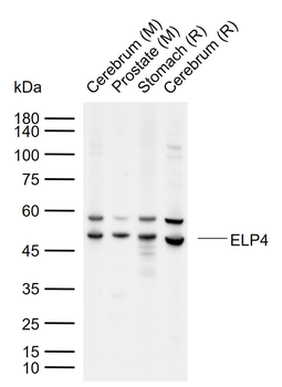ELP4 Rabbit Polyclonal Antibody