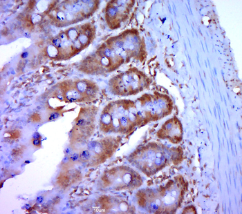 Eps8L3 Rabbit Polyclonal Antibody