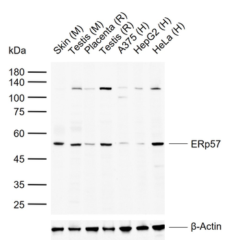 ERp57 Rabbit Polyclonal Antibody