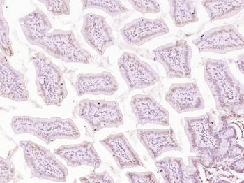 ESCO2 Rabbit Polyclonal Antibody