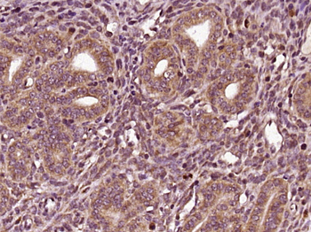 Phospho-Estrogen Receptor alpha (Ser104) Rabbit Polyclonal Antibody