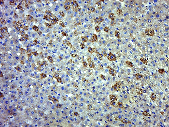 EVI5L Rabbit Polyclonal Antibody