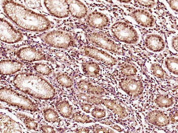EVPLL Rabbit Polyclonal Antibody