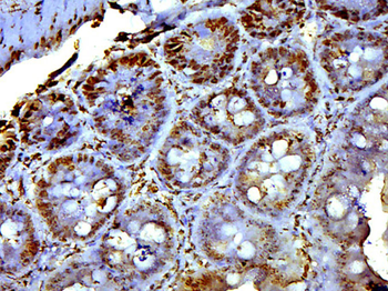 EXOC6B Rabbit Polyclonal Antibody