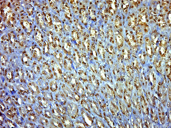 EXOC6B Rabbit Polyclonal Antibody