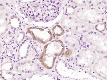 Endothelial lipase Rabbit Polyclonal Antibody