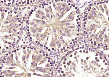 FAM172A Rabbit Polyclonal Antibody