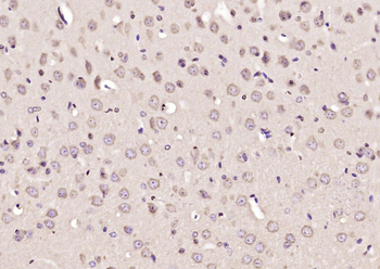 COMMD10 Rabbit Polyclonal Antibody