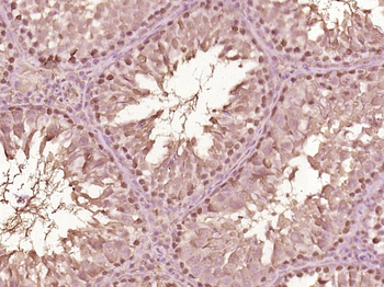 FIAA Rabbit Polyclonal Antibody