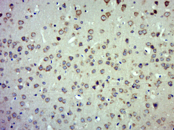 FAM151B Rabbit Polyclonal Antibody