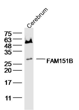 FAM151B Rabbit Polyclonal Antibody