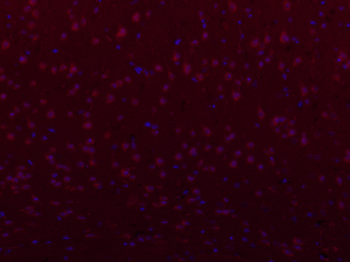 PIEZO1 Rabbit Polyclonal Antibody