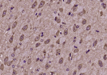FAM49A Rabbit Polyclonal Antibody