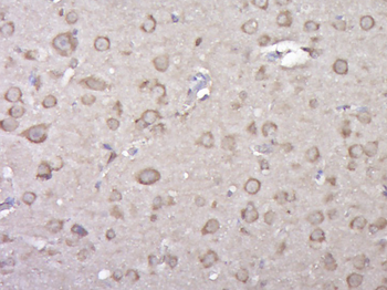FAM5C Rabbit Polyclonal Antibody