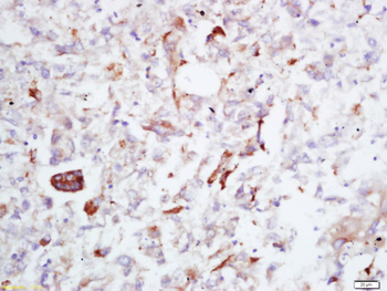 FAPP2 Rabbit Polyclonal Antibody