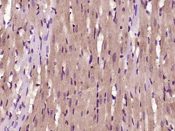 FBX40 Rabbit Polyclonal Antibody