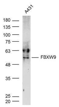 FBXW9 Rabbit Polyclonal Antibody