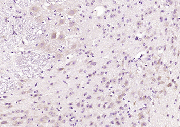 FKBP1B Rabbit Polyclonal Antibody