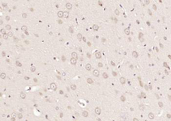 FKBP1B Rabbit Polyclonal Antibody