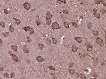 AAGAB Rabbit Polyclonal Antibody