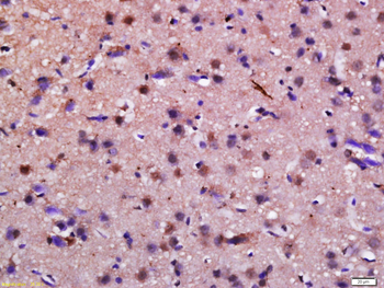 FLJ20097 Rabbit Polyclonal Antibody