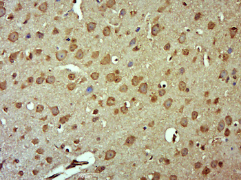 RUFY4/FLJ46536 Rabbit Polyclonal Antibody