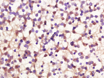 FOXB2 Rabbit Polyclonal Antibody