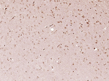 FOXJ3 Rabbit Polyclonal Antibody