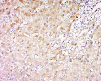 FRY/C13orf14 Rabbit Polyclonal Antibody
