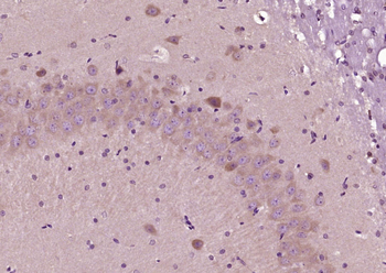 FUT10 Rabbit Polyclonal Antibody