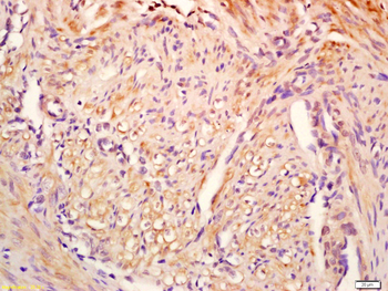 GCDFP15 Rabbit Polyclonal Antibody