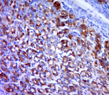 GAK Rabbit Polyclonal Antibody