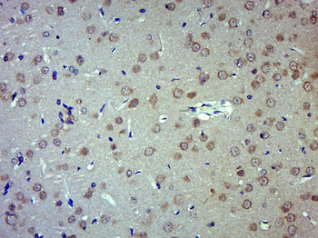 GALNT9 Rabbit Polyclonal Antibody