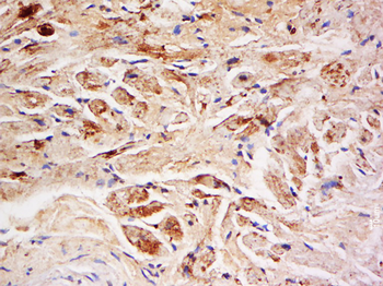 Gamma Sarcoglycan Rabbit Polyclonal Antibody