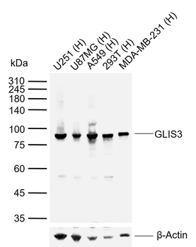 GLIS3 Rabbit Polyclonal Antibody