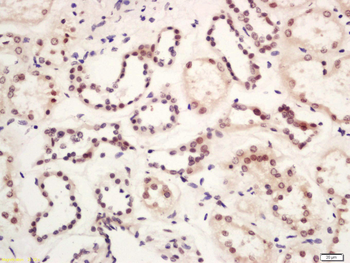 GLIS3 Rabbit Polyclonal Antibody