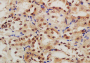 GLIS3 Rabbit Polyclonal Antibody